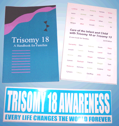 Trisomy on If You Are The Parent Of An Infant With Trisomy 18 Please Fill Out